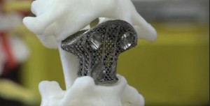 vertebra artificiale stampata in 3d