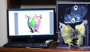 radiologia e stampa 3d